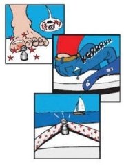 Tente Branda Çıtçıt ÜST PARÇA BYZ